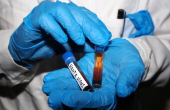 Hantavirus, negativi i test analizzati a Milano e allo Spallanzani